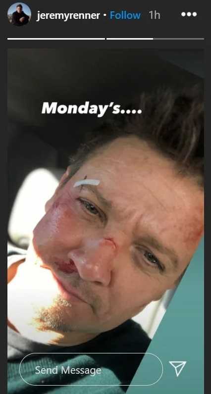 A selfie from Jeremy Renner as character Clint Barton, with a scratch on his nose, eyebrow and a bloody nose. Featuring the caption "Monday's..."